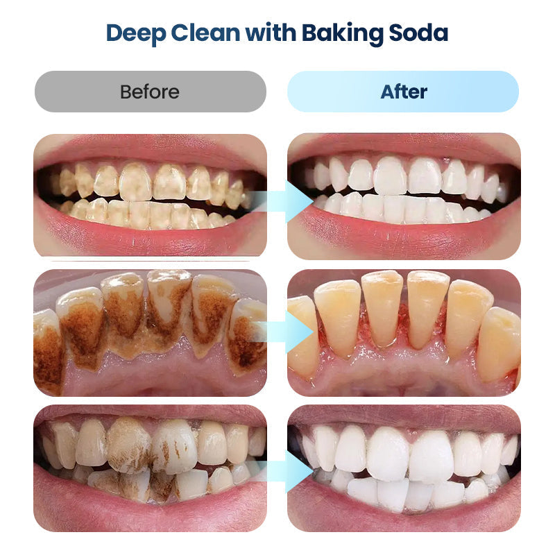 🦷 Rire de la vie 🔥| Dentifrice blanchissant et haleine fraîche au bicarbonate de soude