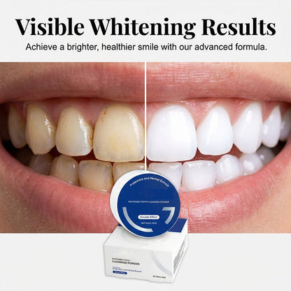 😁 Kit de blanchiment des dents – Sourire éclatant à domicile | -50% 🔥
