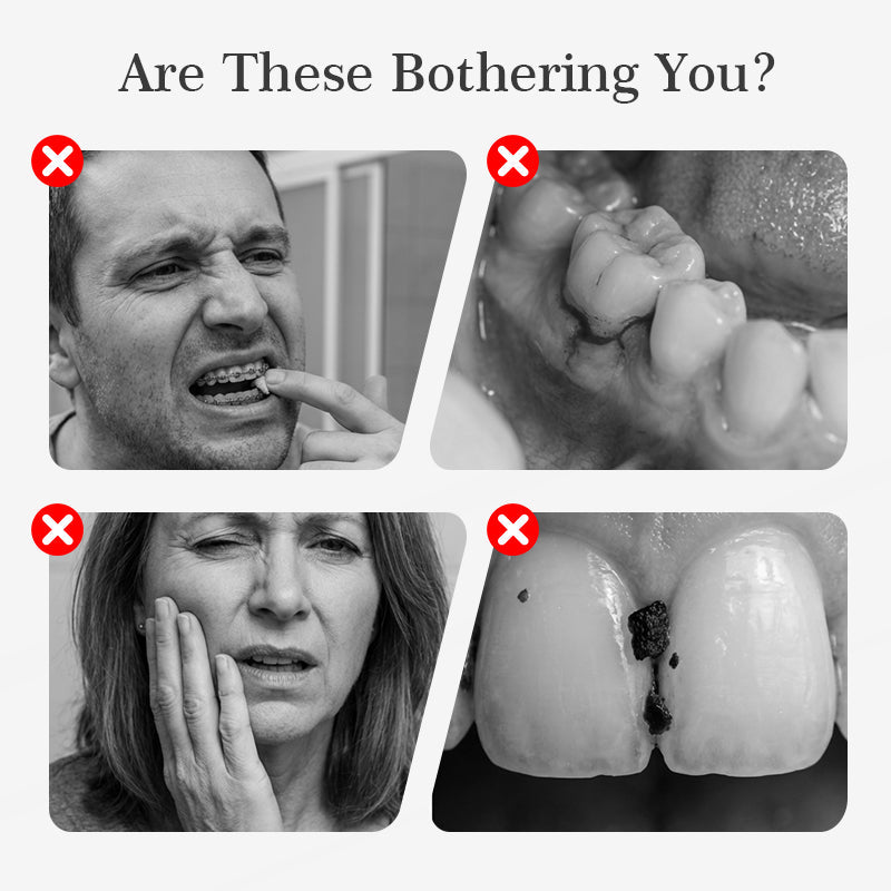 😁 Kit de blanchiment des dents – Sourire éclatant à domicile | -50% 🔥