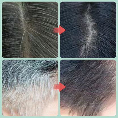 ✨ Shampooing végétal anti-chute – Cheveux plus forts et sans pellicules | -52% ⚡